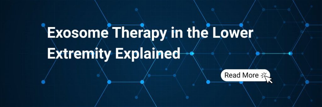 Exosome therapy for joint pain in Ohio and Chicago with regenerative options