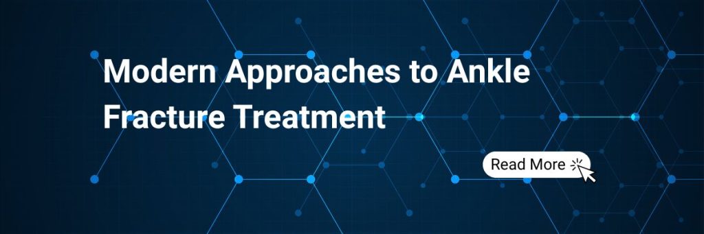 Modern Approaches to Ankle Fracture Treatment