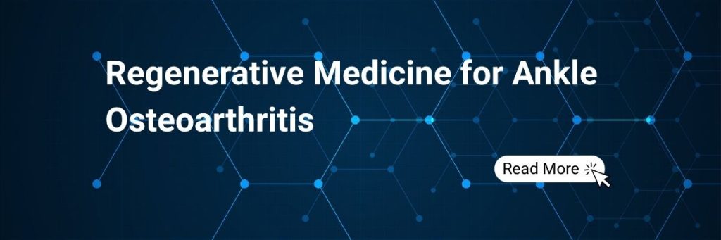 Regenerative Medicine for Ankle Osteoarthritis: How a Lower Leg Conditions Clinic Uses BMAC and Stem Cell Therapy to Help Patients Avoid Fusion Surgery