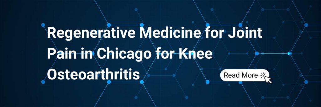 Standard Care vs. Regenerative Medicine for Joint Pain in Chicago for Knee Osteoarthritis
