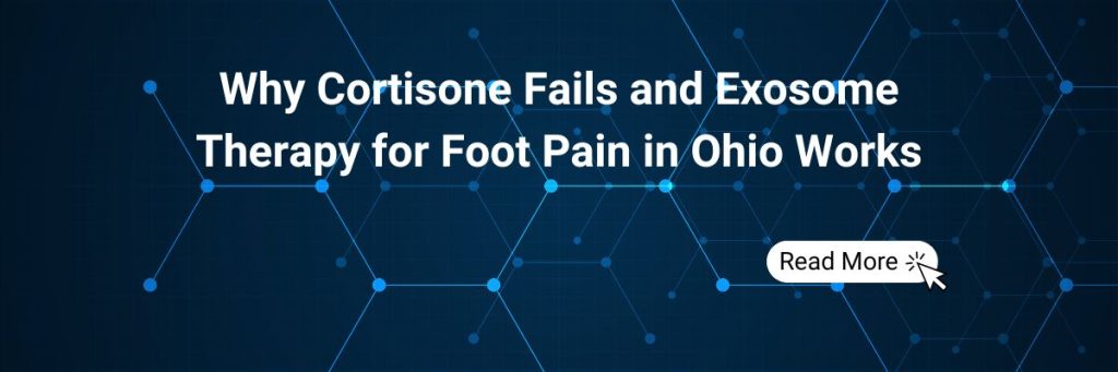 Why Cortisone Fails and Exosome Therapy for Foot Pain in Ohio Works
